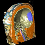 Mummy's head with a mid-sagittal cut