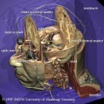 Virtual dissection of the Visible Human's brain