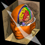 VOXEL-MAN Brain and Skull 3D atlas