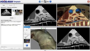 Training in abdominal ultrasound with target view (bottom right) and interactively achieved view (top)